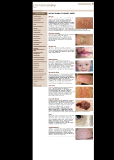 Dermatologia24.pl